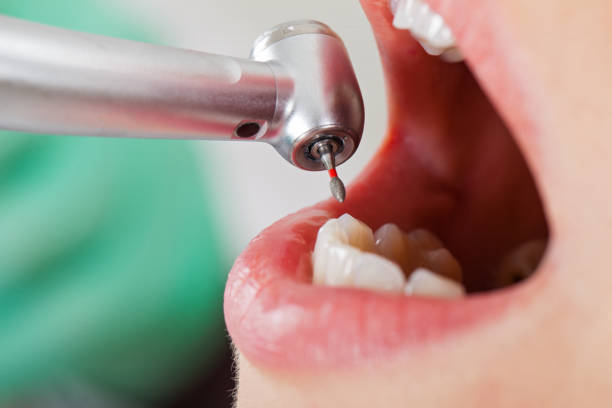 Tooth Infection Emergency Dentist in WA